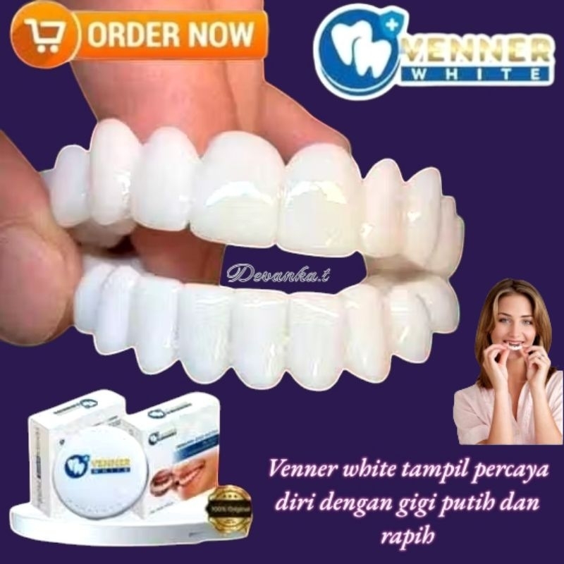 [Bayar di Tempat] VENEER WHITE gigi palsu instant 100% ORIGINAL atas dan bawah kualitas terbaik