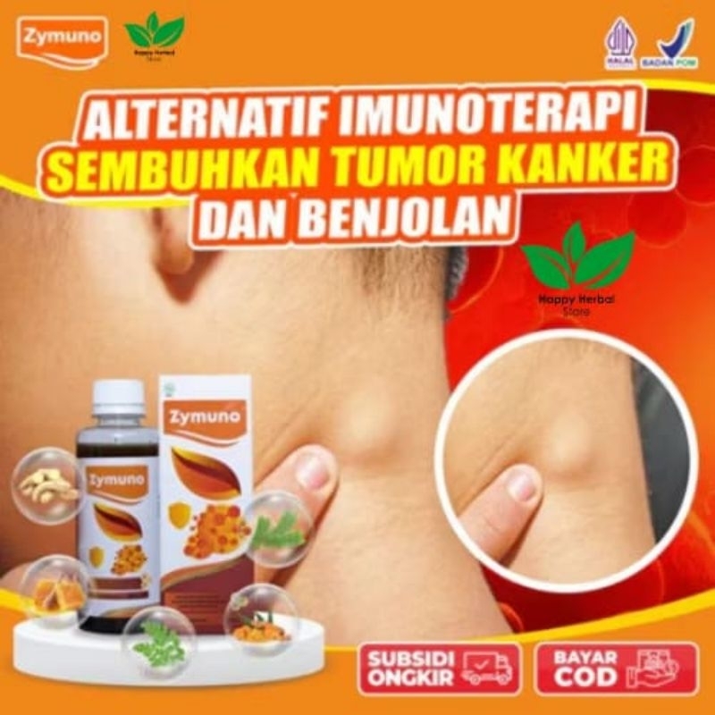 

Zymuno Alternatif Immunoterapi Sembuhkan Tumor Kanker dan Benjolan Original