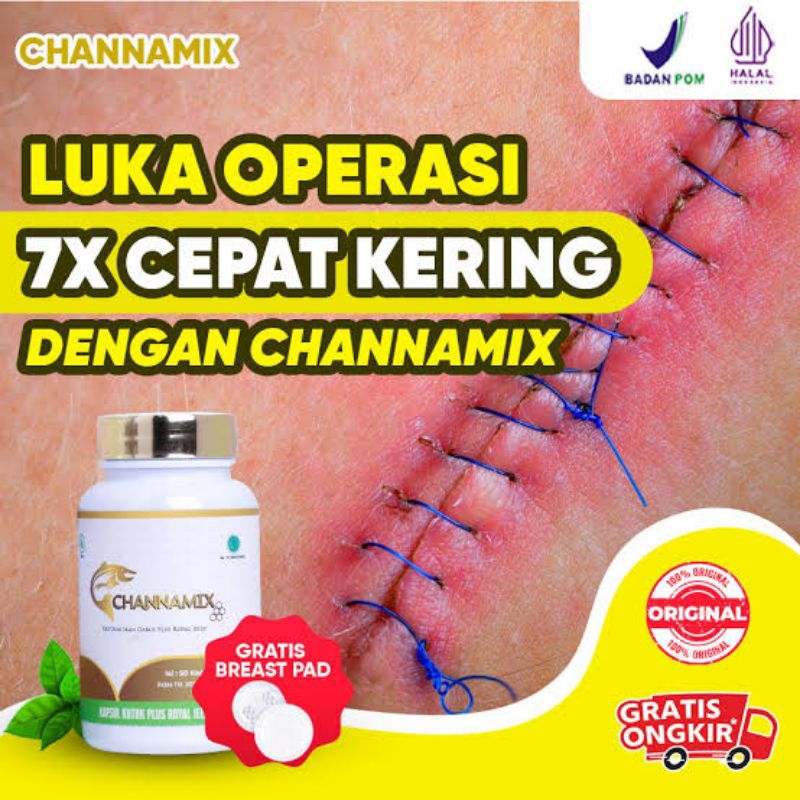 Channamix Kapsul Ekstrak Ikan Gabus Isi 60 Kapsul,Kapsul Kutuk
