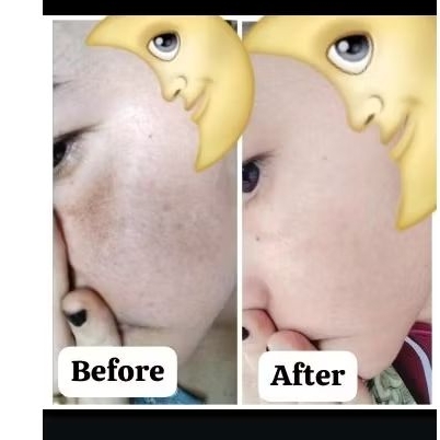 crem racikan dokter,bisa juga untuk flek