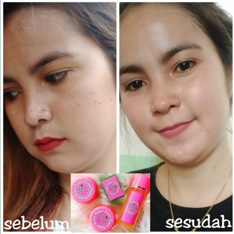 paket Cepat glow up cantika skincare