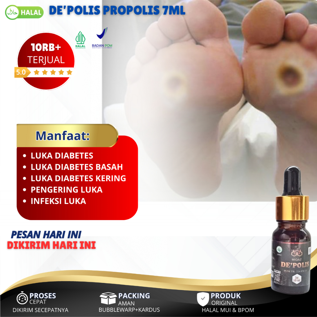 Obat Luka Diabetes, Pengering Luka Diabetes, Luka Diabetes Basah, Luka Diabetes Melitus, Luka Diabet