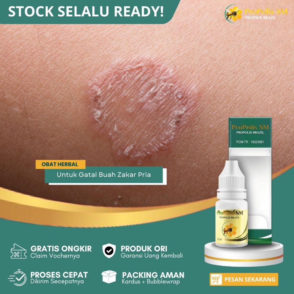 Obat Gatal Buah Jakar, Obat Gatal Pada Kulit Buah Zakar, Obat Gatal Gatal Buah Zakar, Gatal Kelamin