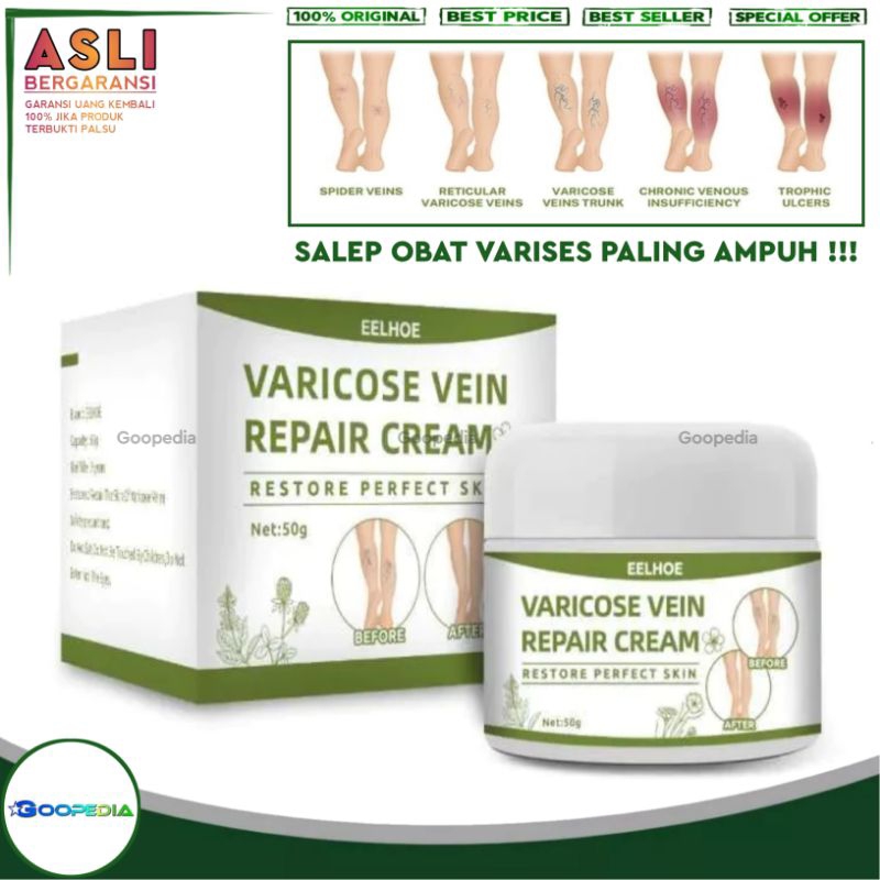 [ ORIGINAL 100% ] EELHOE VARICOSE VEIN REPAIR CREAM | KRIM SALEP PENGHILANG VARISES URAT VENA KAKI M