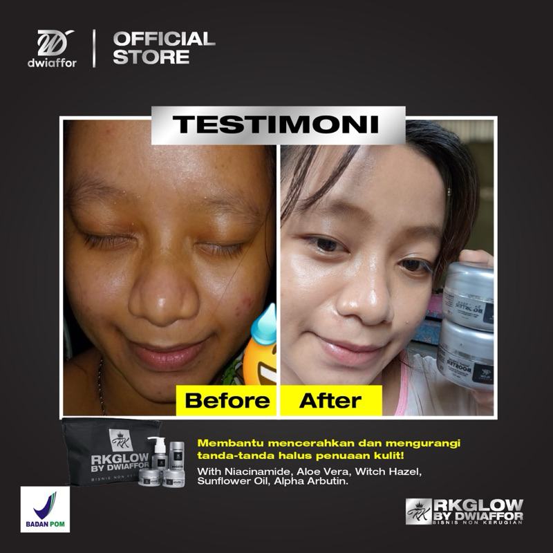 Paket cream RK GLOW whitening acne flek