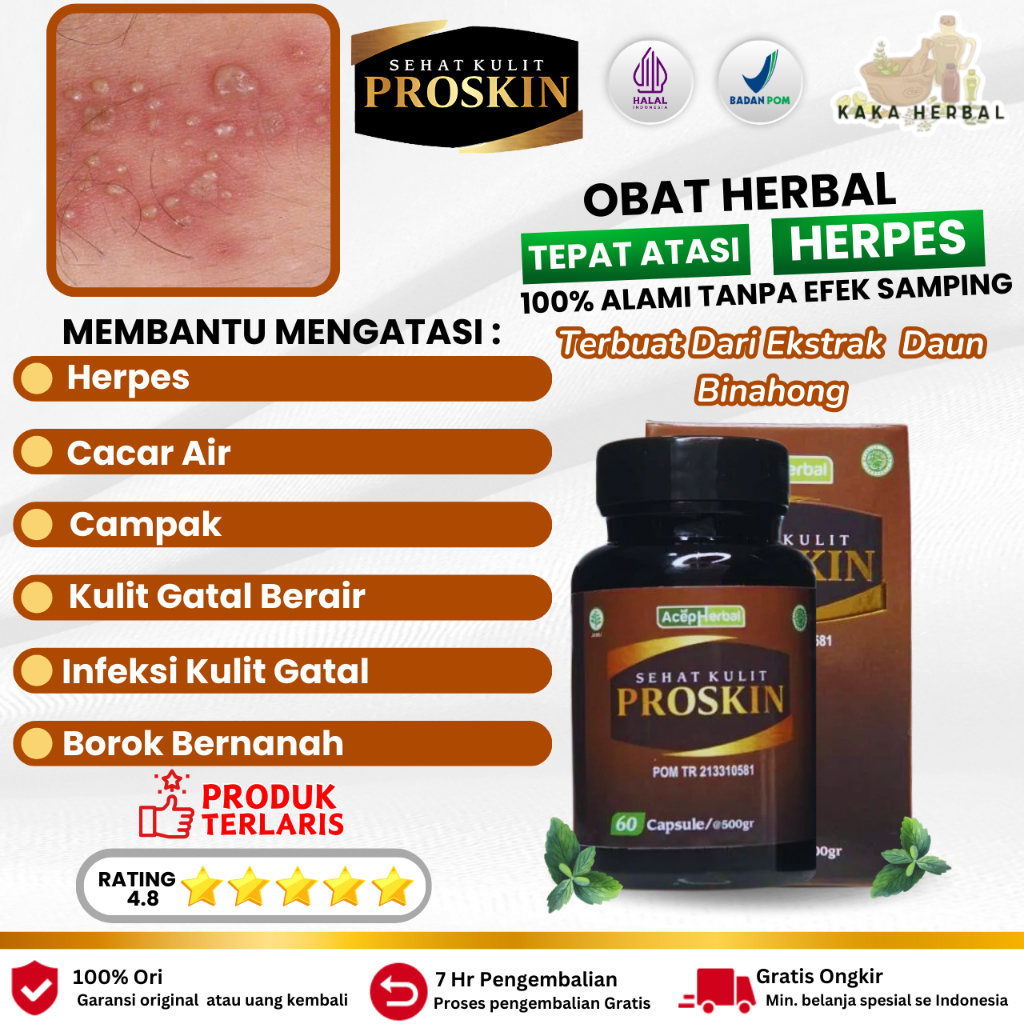 Kaka Herbal - Obat Herpes Kulit, Obat Herpes Genital, Obat Herpes Kelamin, Bintik Bintik Perih Di Ke