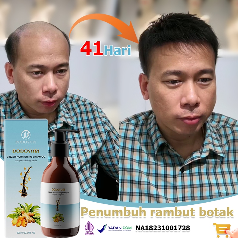 DODOYURI Shampoo rambut rontok Sampo rambut rontok Shampo penumbuh rambut cepat Shampo rambut rontok