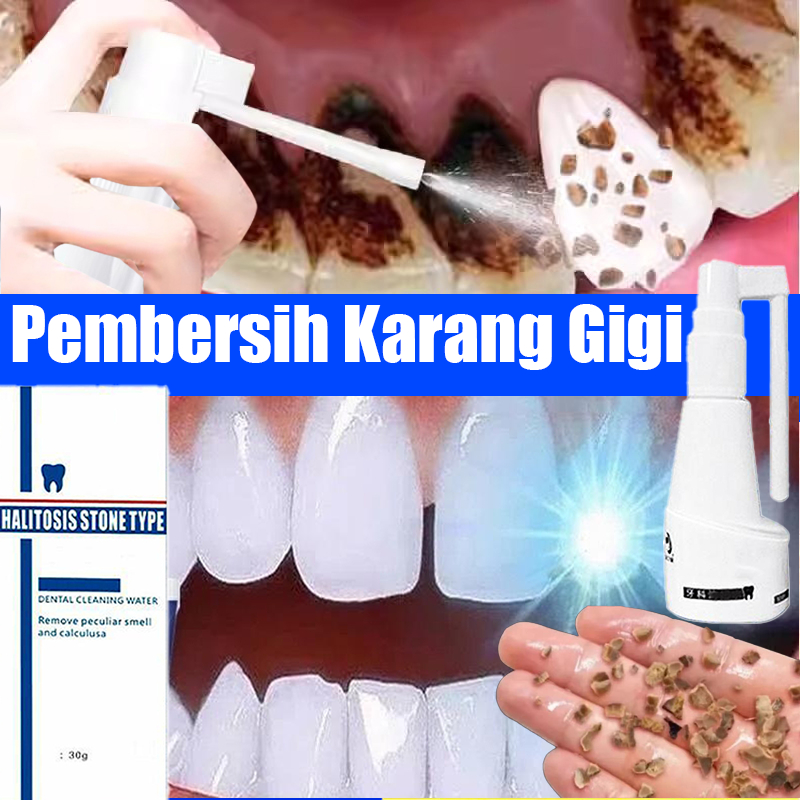 Pembersih Karang Gigi Pembersih Gigi Kuning Perontok Karang Gigi Paling Ampuh Alat Pembersih Karang 