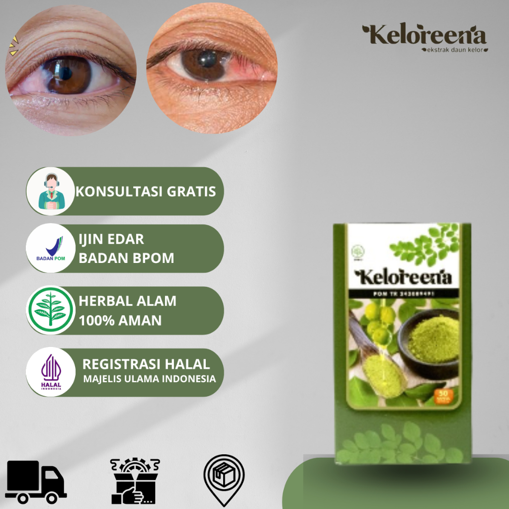 Keloreena Obat Mata Berlemak Kekuningan Penyakit Pterigium Ada Selaput di Bagian Putih Bola Mata Pin