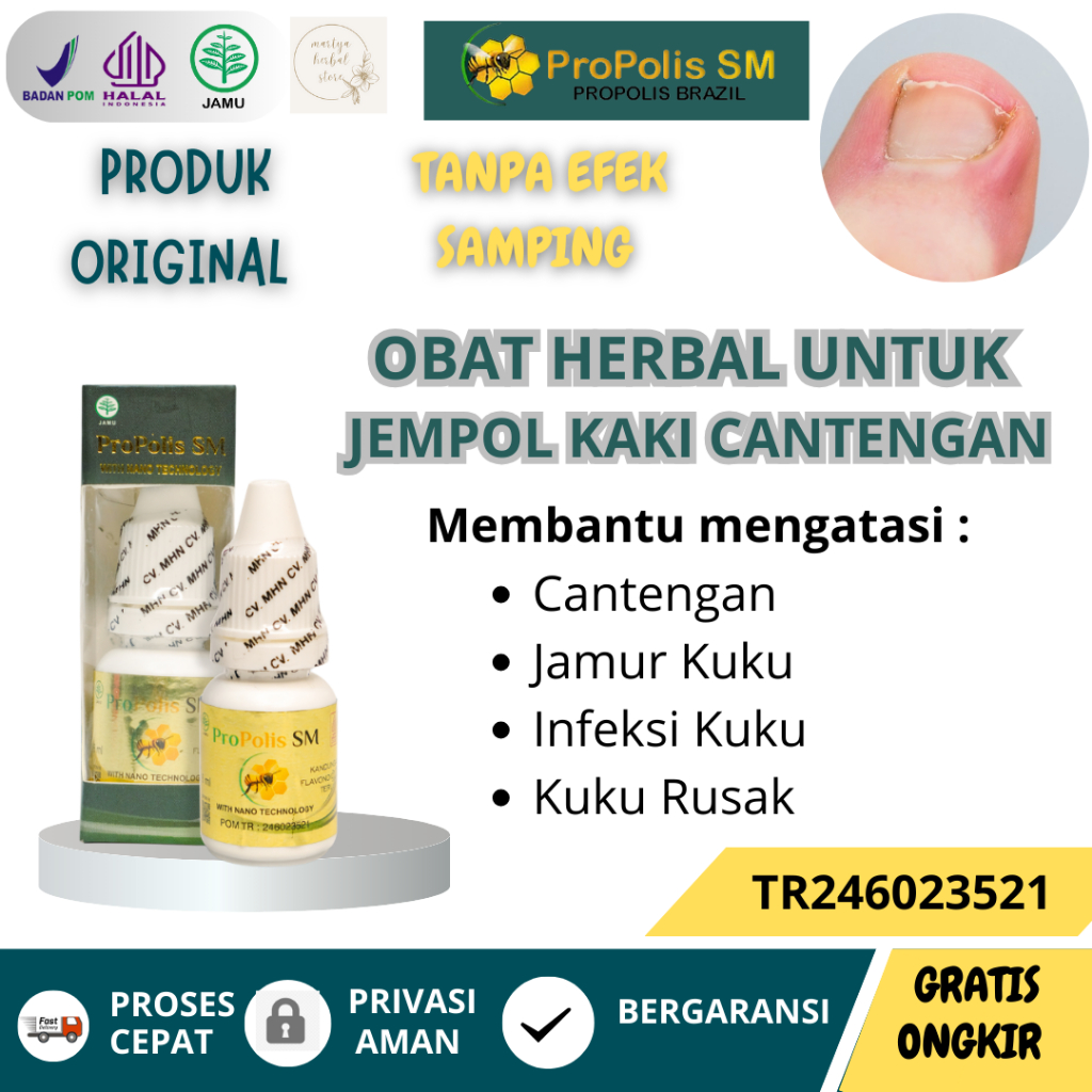 Obat  Herbal Tetes Cantengan Jempol Kaki, obat Kuku Cantengan, obat Jempol Kaki Bernanah, obat Jamur