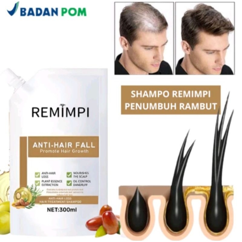 REMIMPI OFFICIAL Shampoo Remimpi Anti Hair Fall Hair Treatment - Anti Rambut Rontok Penumbuh Rambut