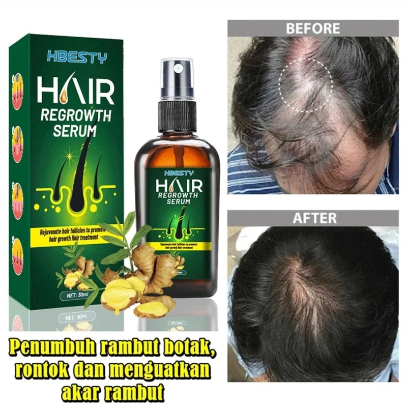 Ori ampuh Penumbuh rambut cepat dan tebal Menyehatkan Kulit Kepala&Meningkatkan Regenerasi Rambut Pe