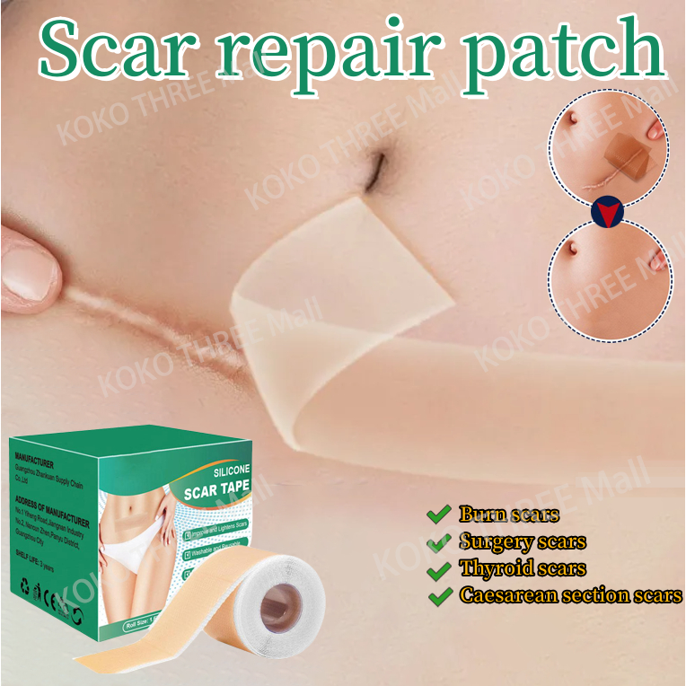 Silicone Scar Sheet plester silikon penghilang keloid bekas luka Silicon Keloid Plester Bekas Luka S