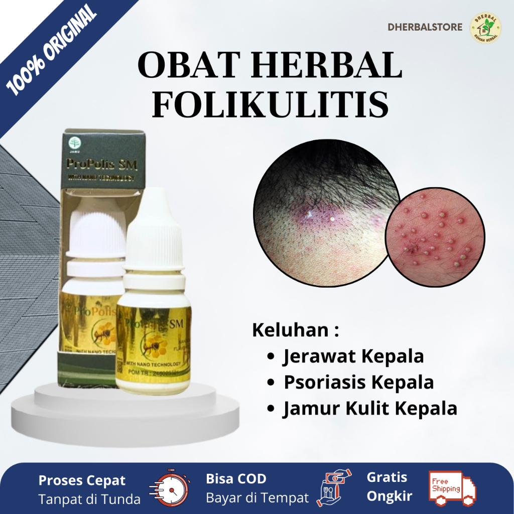 Obat Folikulitis, Obat Radang Folikel Rambut, Obat Jerawat di Kepala, Obat Jamur Kepala, Obat Psoria