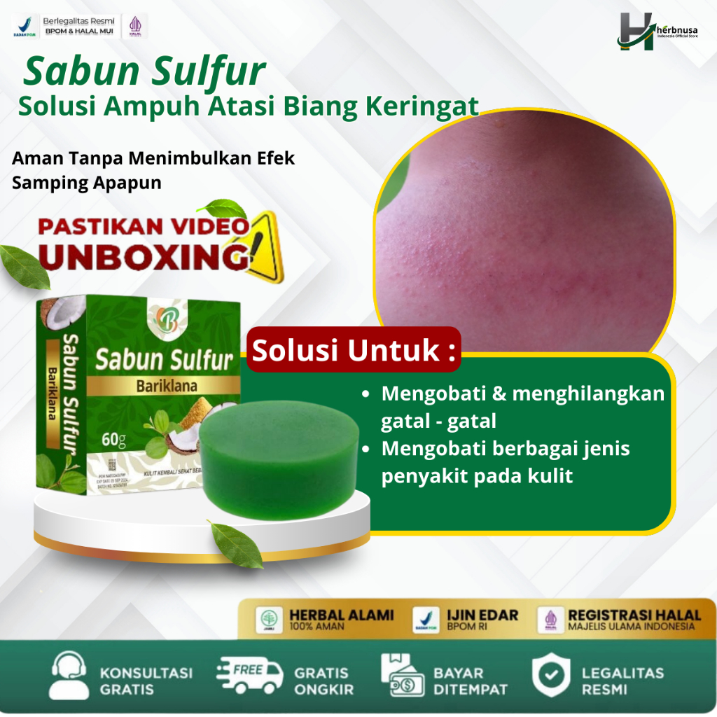 Obat Biang Keringat, Miliaria Rubra, Gatal Kulit, Gatal Seluruh Badan, Kaligata, Biduran, Bintik Bin