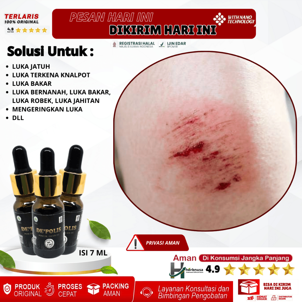 de'polis propolis asli 100% original solusi untuk obati luka jatuh obat tetes luka jatuh penghilang 
