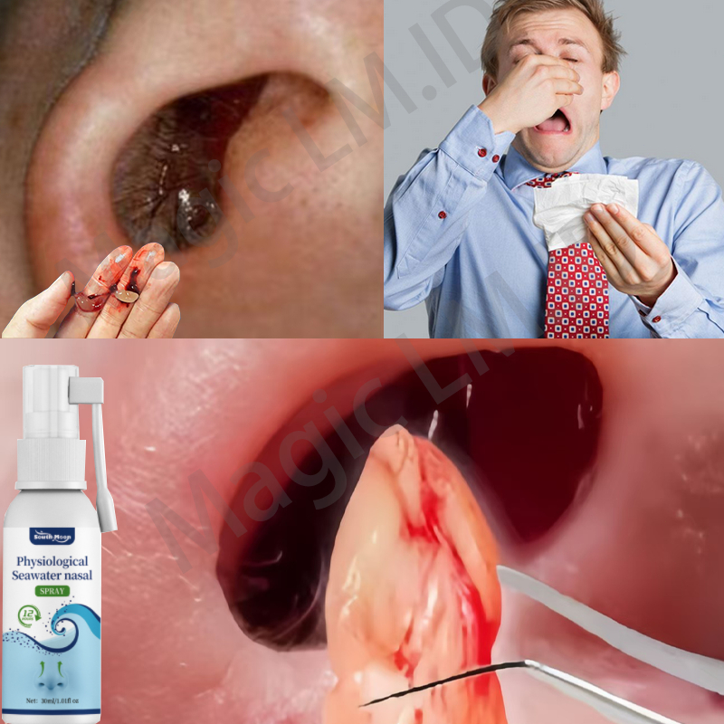 nasal spray obat sinusitis obat polip hidung cairan nacl pembersih hidung nasal spray bayi alat penc