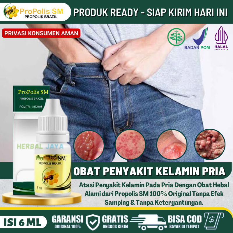 Obat Herbal Balanitis di Kemaluan Pria, Obat Perih Lecet di Kepala Penis, Penghilang Bentol - Bentol