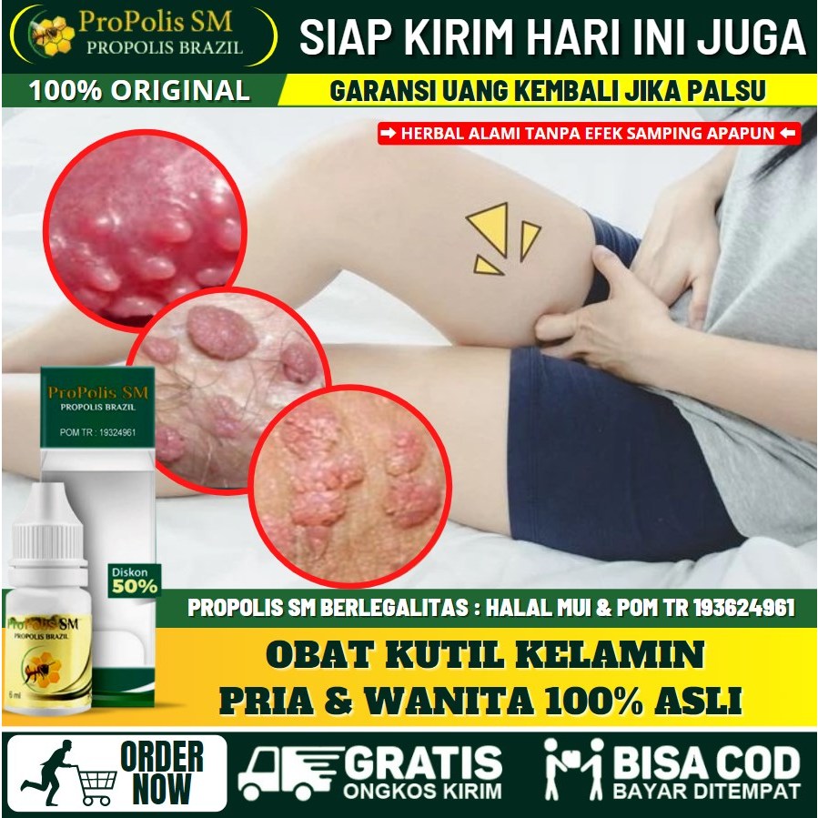 Salep Oles Kutil Kelamin Pada Pria Dan Wanita Obat Benjolan Kecil di Organ Intim Obat Gatal di Area 