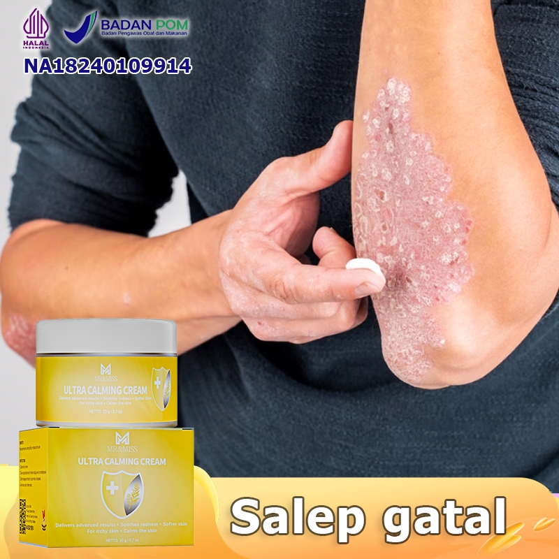 MR&MISS Obat gatal selangkangan Obat panu Salep gatal Obat kurap 20g Obat gatel Obat eksim Obat gata