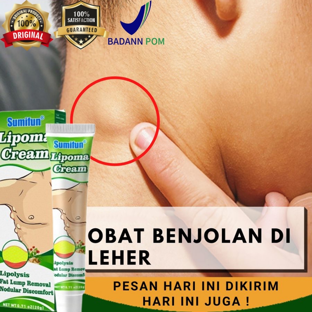 Lipoma Cream Obat Benjolan Lipoma Krim Salep Lipoma Ampuh Obat 20gr Lipoma Cream Obat Benjolan Lipom