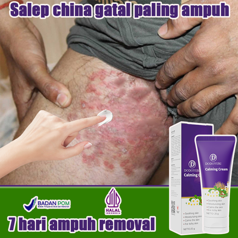 Salep china gatal paling ampuh obat gatal selangkangan salep gatal jamur selangkangan salep gatal 20
