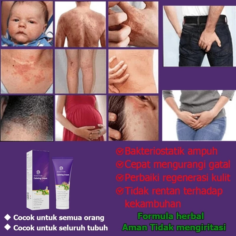 RB Salep gatal jamur selangkangan Obat gatal Salep gatal china paling ampuh Obat gatal selangkangan
