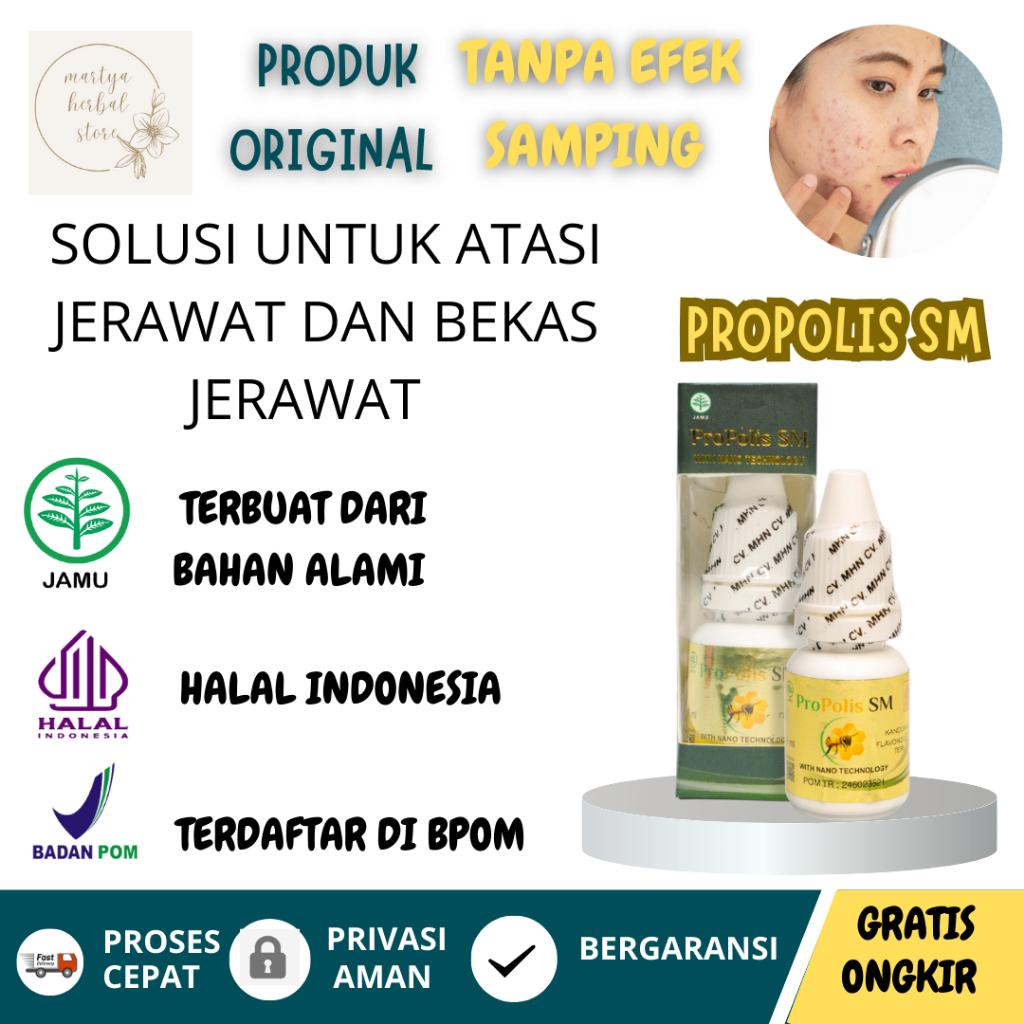 PROPOLIS SM Obat Totol Jerawat Obat Penghilang Bekas Jerawat Obat Gatal Kulit