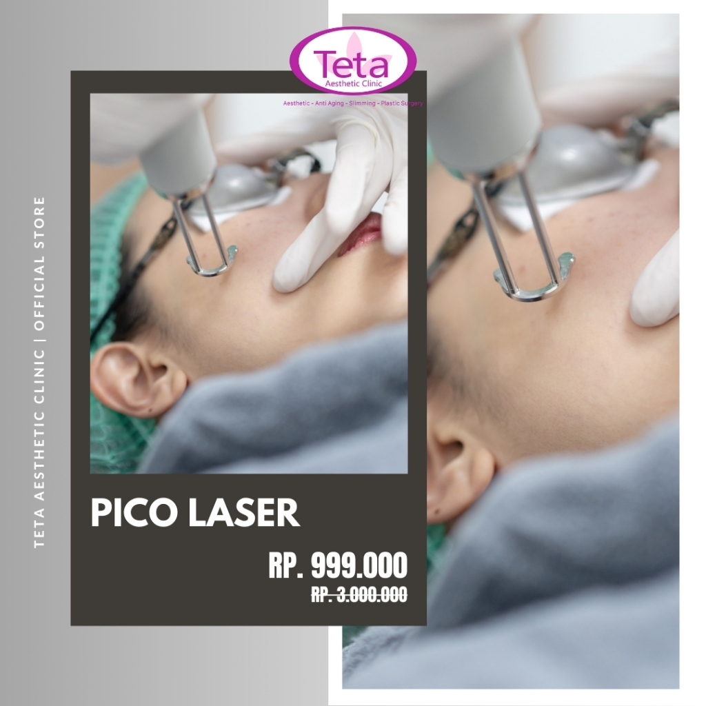 TETA Pico Laser for Acne, Flek Removal, & Rejuve