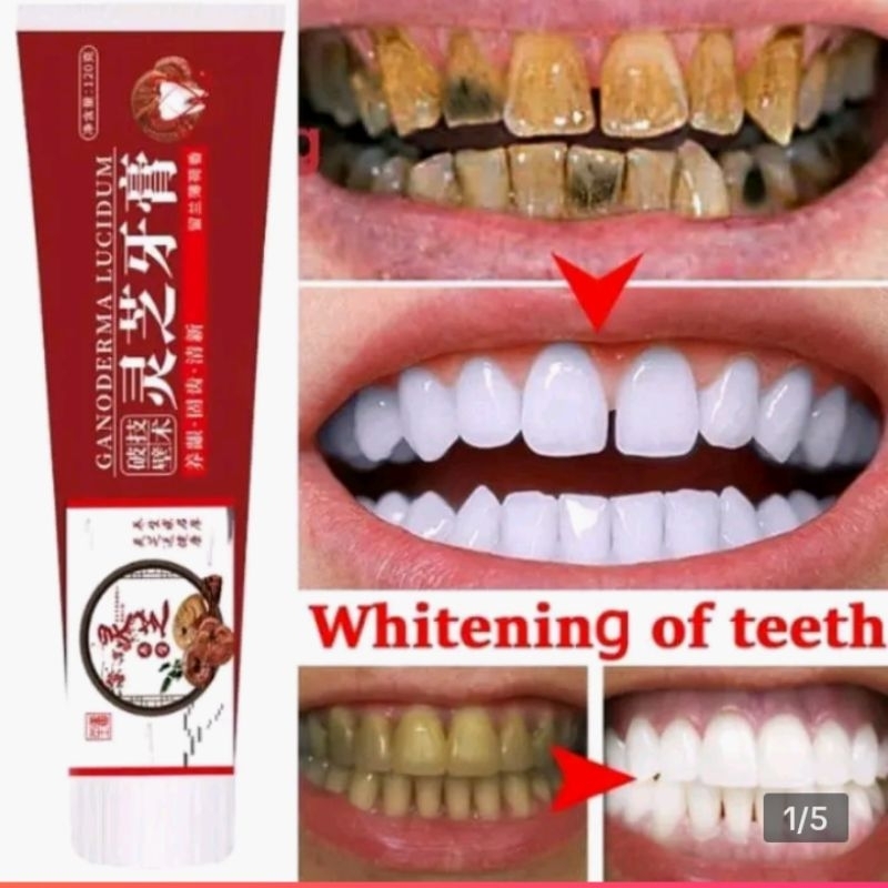Pasta gigi Ganoderma Lucidum... memutihkan gigi , merontokkan karang gigi