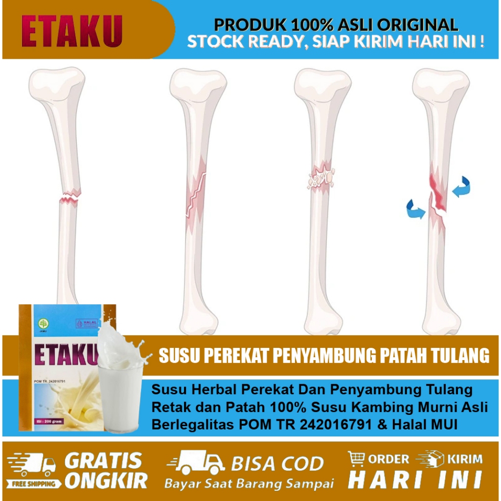 Obat Patah Tulang Retak Tulang Kalsiun Tulang Retak Herbal Nutrisi Penyambung Perekat Tulang - Etaku