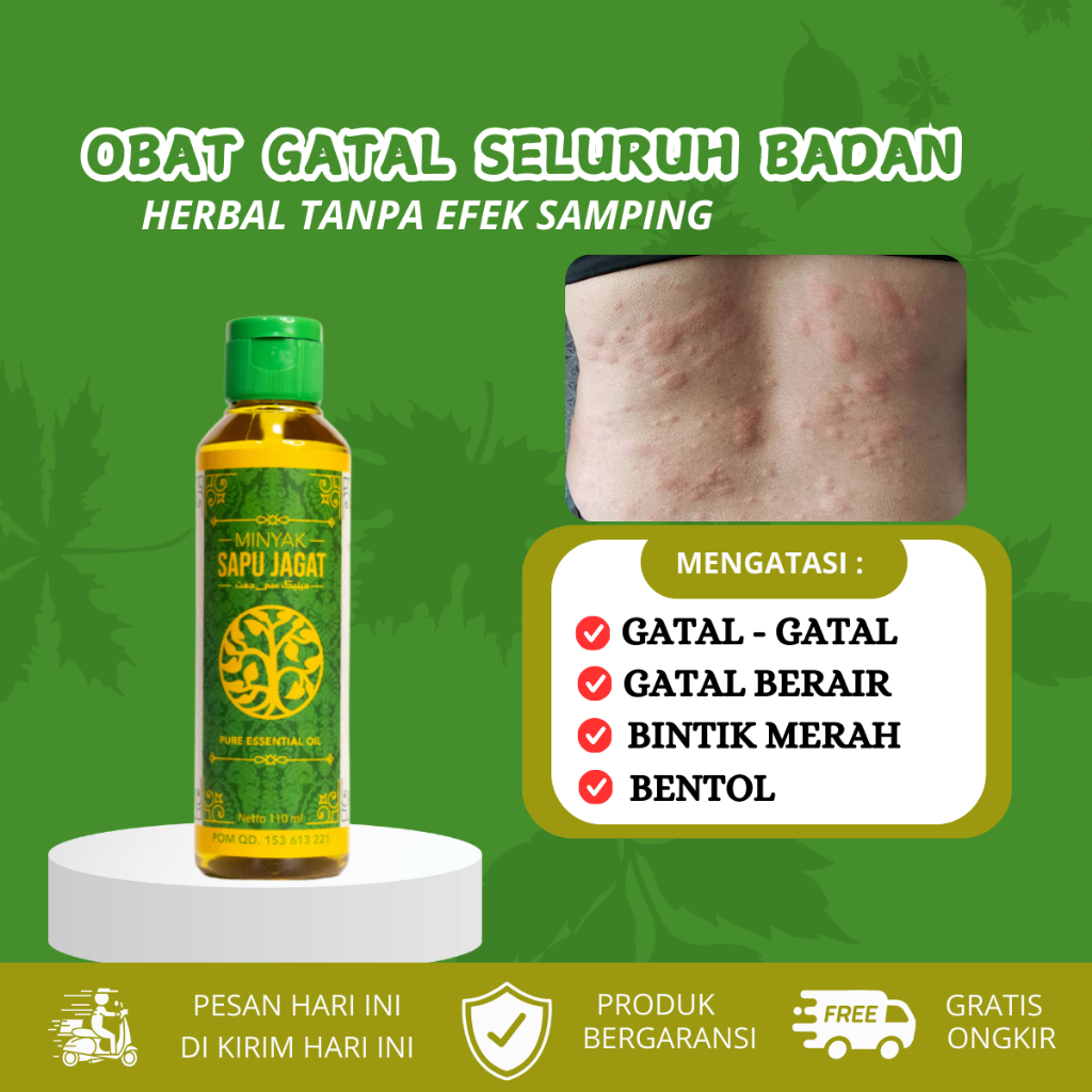 Obat Gatal Seluruh Badan, Gatal Berair, Bintik Bintik Merah, Bentol Pada Kulit