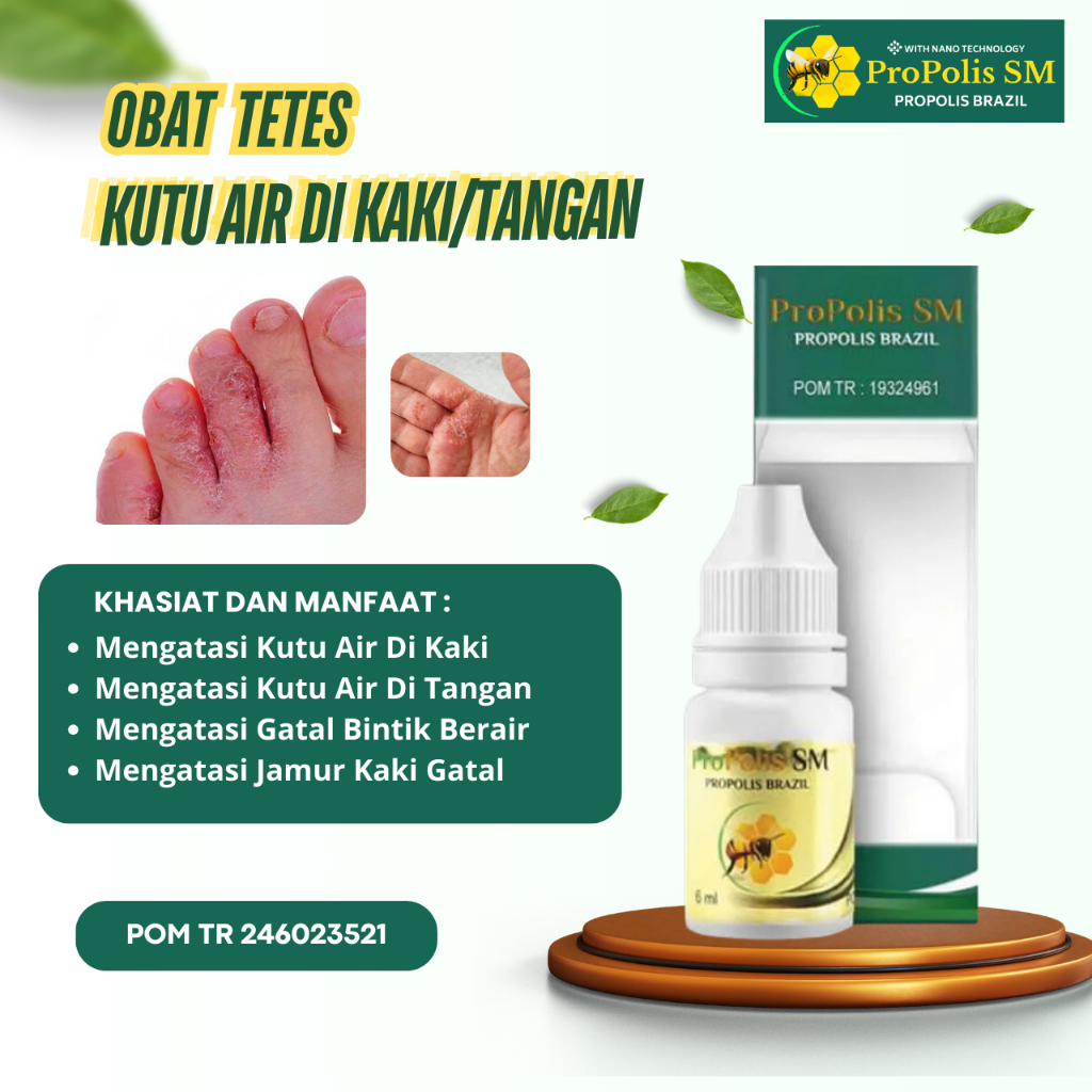 Obat Kutu Air Kaki, Obat Kutu Air Anak, Salep Kutu Air Kaki, Obat Kutu Air Untuk Sela Kaki, Obat Kut