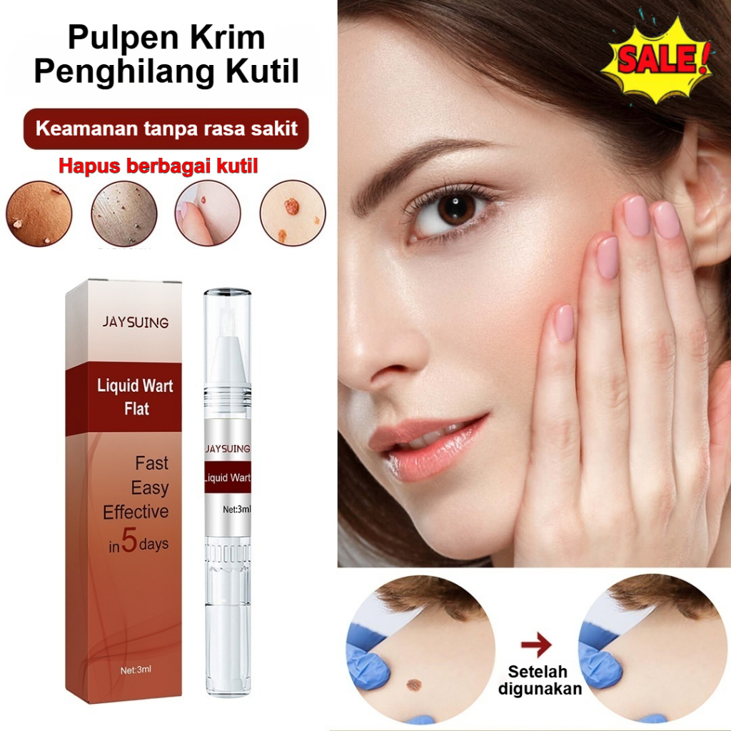 ❤️Beli 1 gratis 2❤️Pensil Obat Kutil untuk Memudarkan Mole dan Kaki Ayam / Pensil Obat Kutil untuk L