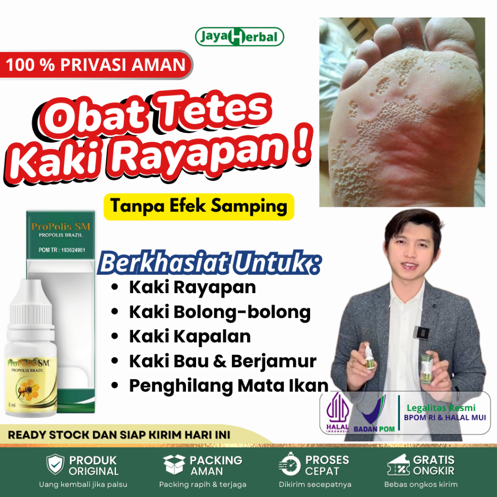 Propolis SM Brazil 100% Asli Sudah Bpom dan Halal - Obat kaki rayapan, Jamur Kuku, Cantengan, Kutil 