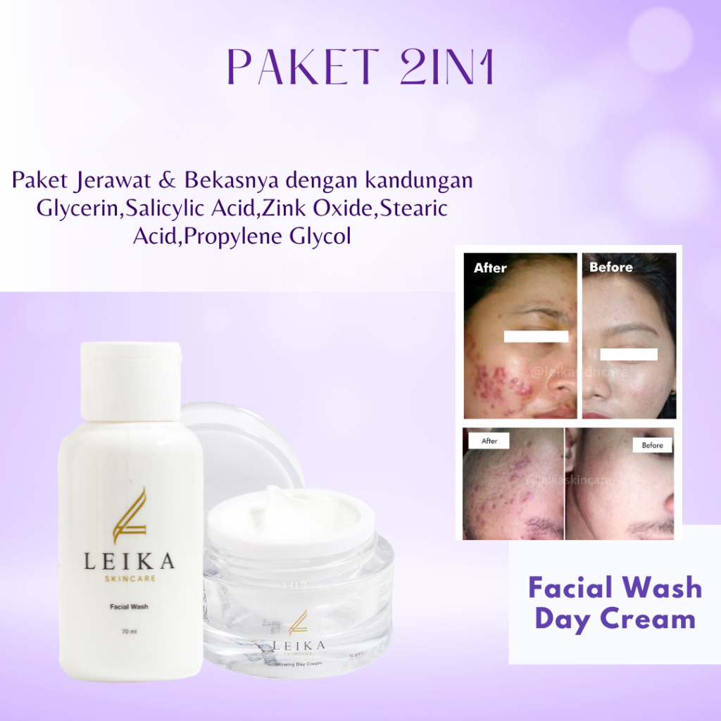 [FACIAL WASH & DAY CREAM] Penghilang Jerawat Ampuh Penghilang Jerawat Dan Bekas Jerawat Penghilang J