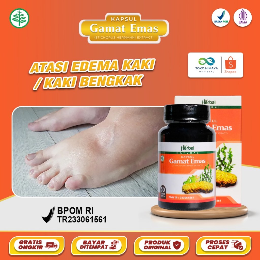 KAPSUL GAMAT EMAS Obat Untuk Kaki Bengkak Edema Kaki / Penumpukan Cairan Di Kaki