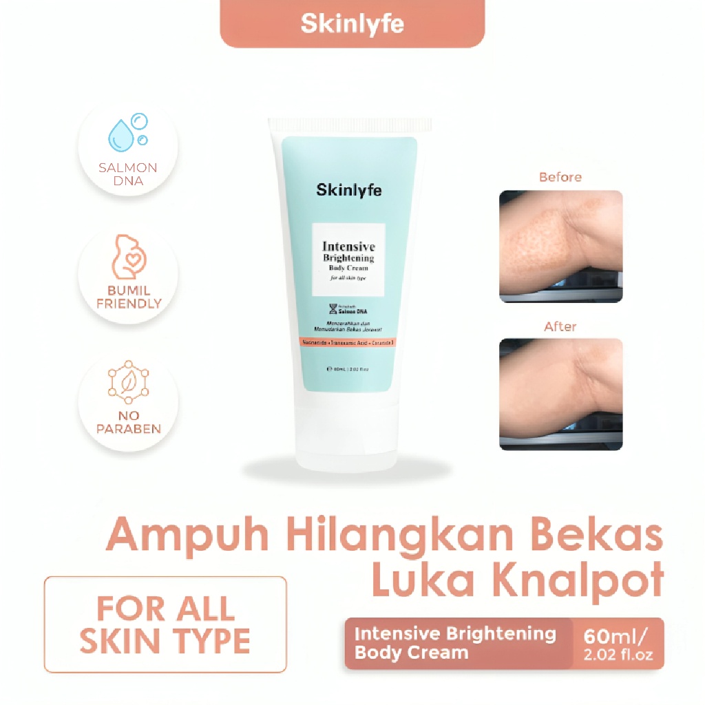 Skinlyfe Cream Pencerah Badan Penghilang Bekas Luka Hitam Koreng Cream Strechmark Salep Bekas Luka