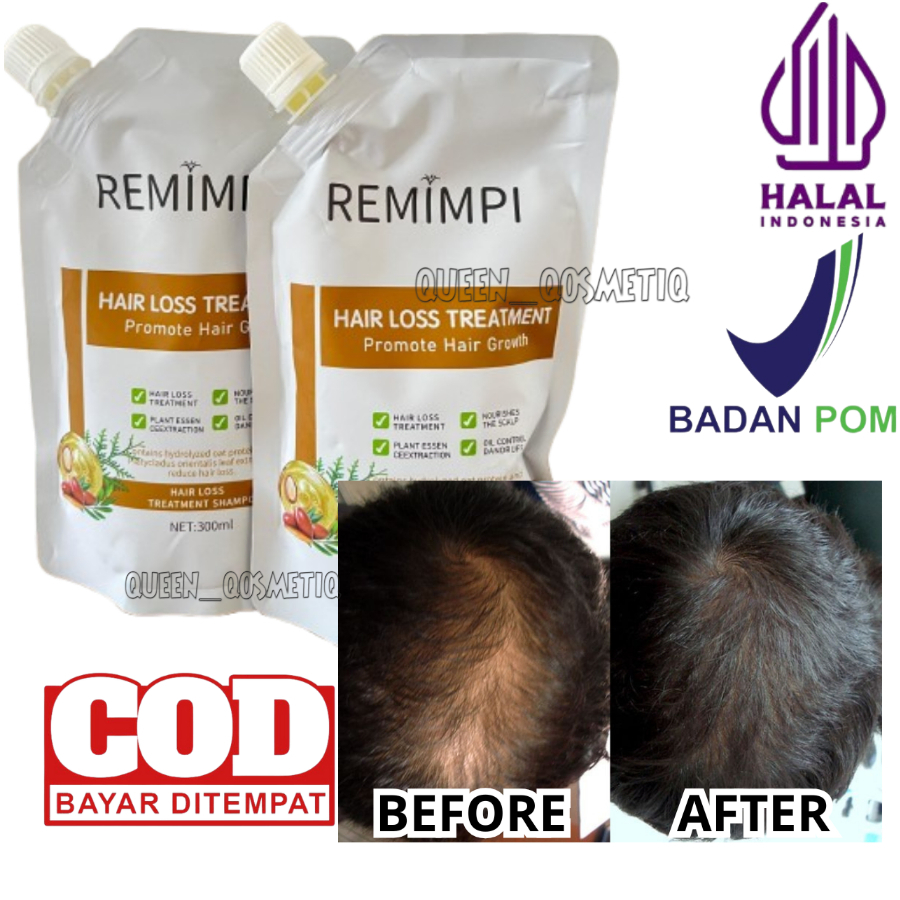 remimpi shampo Rambut rontak bebas ketombe bpom original