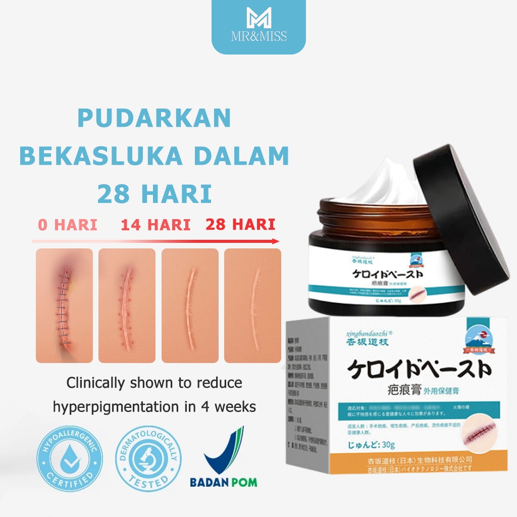 【ORIGINAL】Penghilang bekas luka hitam koreng Salep penghilang bekas luka Obat penghilang bekas luka 