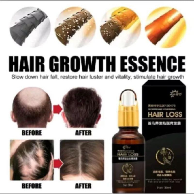 SERUM PENUMBUH RAMBUT BOTAK SERUM PENUMBUH RAMBUT RONTOK WANITA DAN PRIA HAIR TONIC HAIR GROWTH HAIR