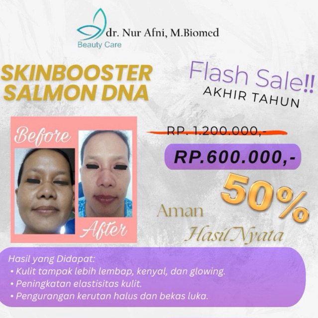 Skin Booster Salmon DNA