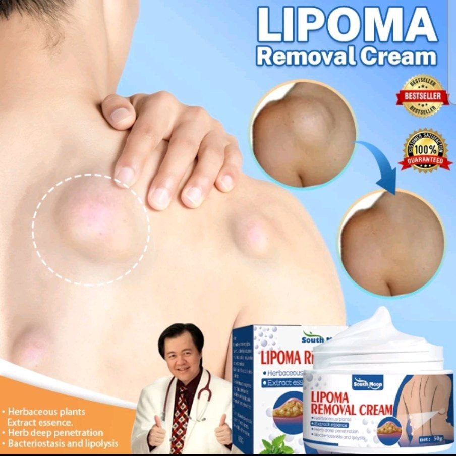 lipoma removal cream / lipoma remover krim lipoma