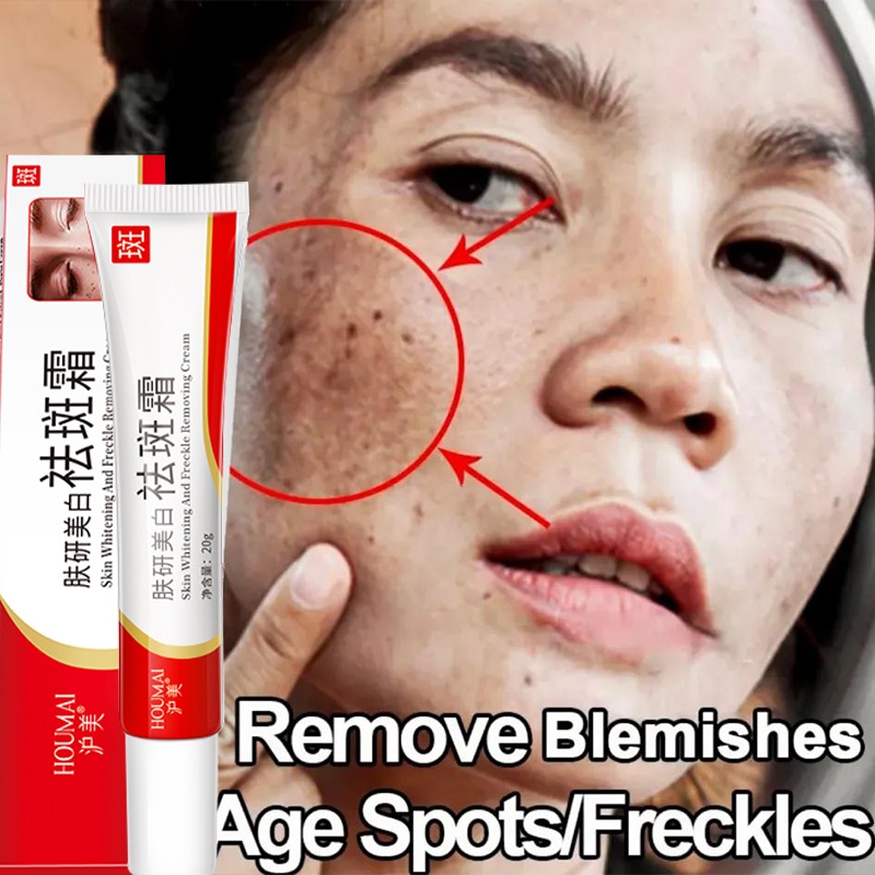 New upgrade Krim Bintik-bintik Pemutih Menghilangkan Bintik-bintik Hitam Krim Anti Bintik-bintik Nia