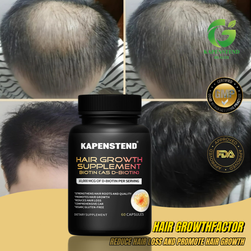Faktor pertumbuhan rambut kebotakan, pertumbuhan rambut cepat, akar rambut stabil, nutrisi mendalam