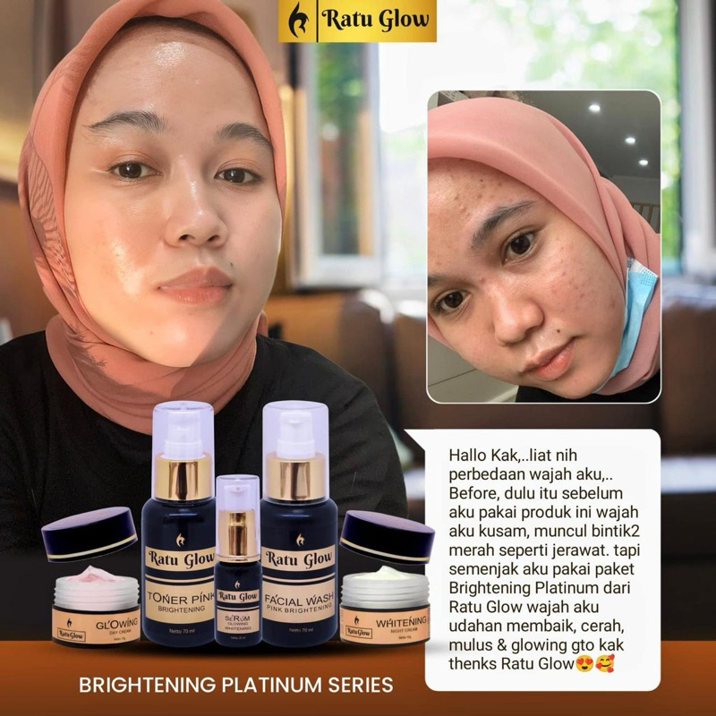 RATU GLOW PLATINUM RATU GLOW SKINCARE BRIGHTENING ACNE PEMUTIH WAJAH PENGHILANG JERAWAT GLOWING ORIG