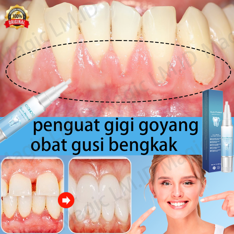 obat gusi bengkak teeth whitening obat sakit gigi ampuh perapi gigi penguat gigi goyang obat gusi tu