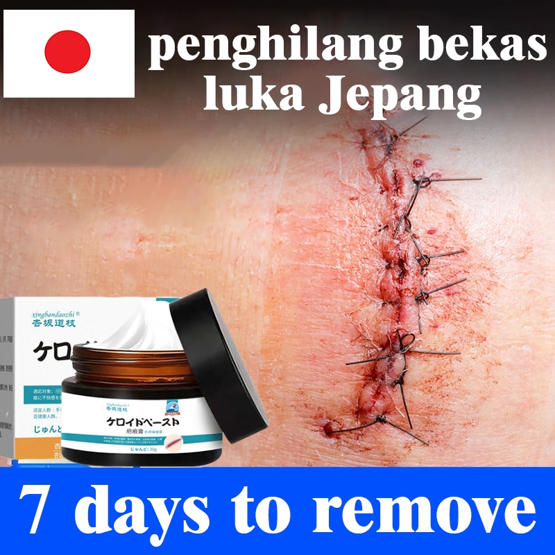 penghilang bekas luka ampuh Obat Penghilang Bekas Luka Jerawat Luka Koreng Paling Ampuh Memudarkan B