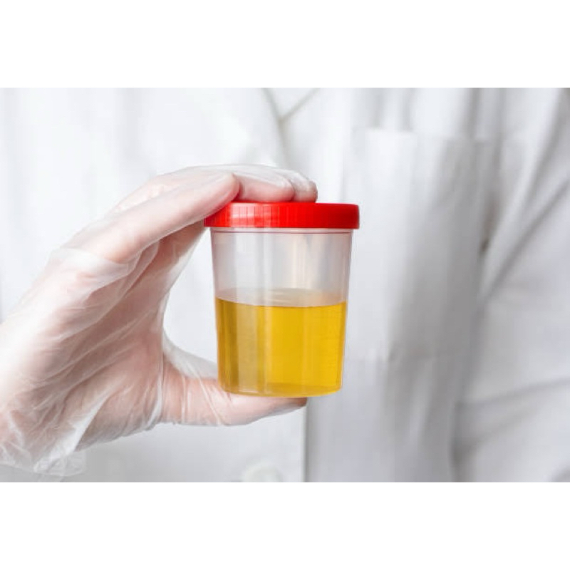 Sample Urine Positif Ibu hamil 30cc (bisa COD)