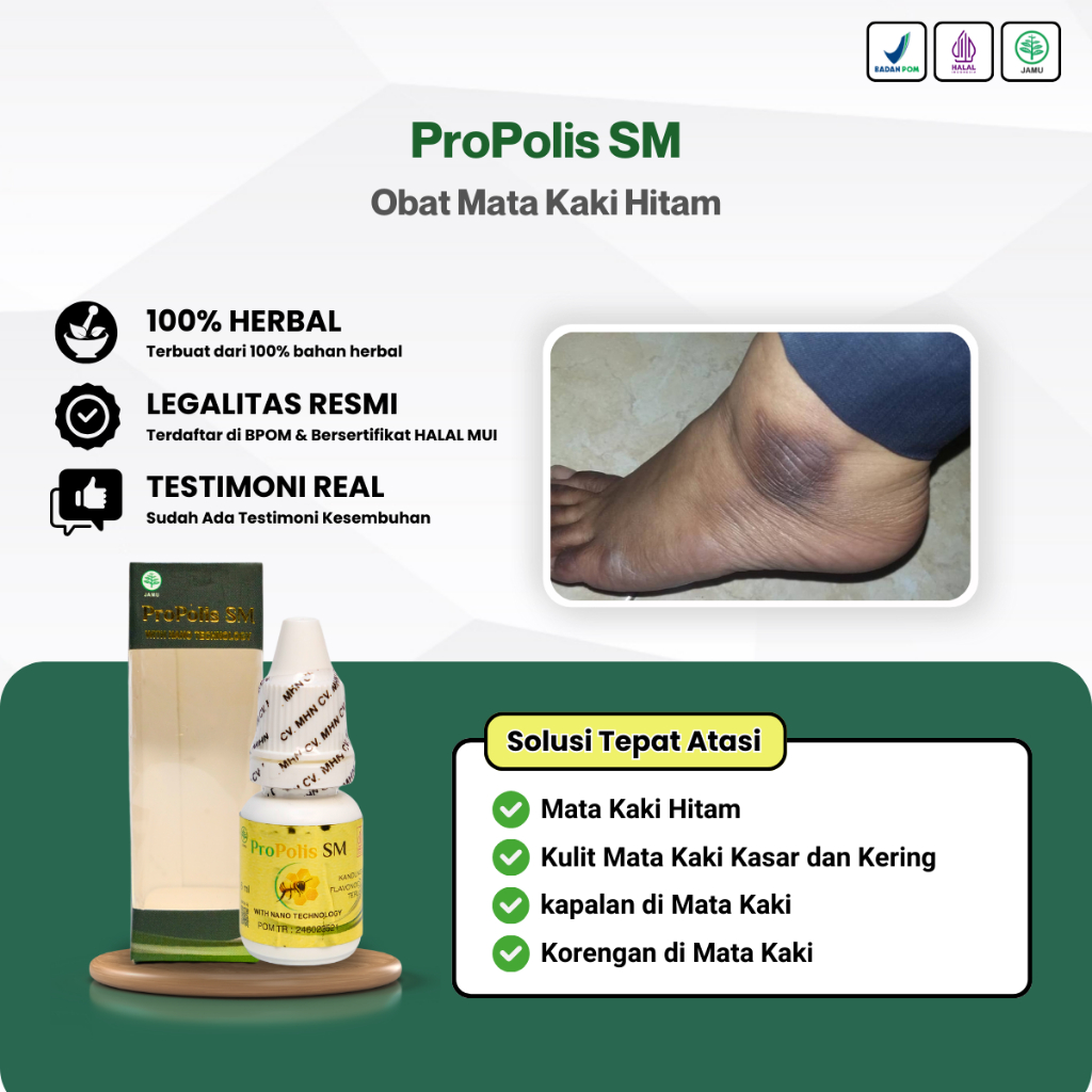 Propolis SM - Obat Mata Kaki Hitam & Kering, Penghilang Hitam di Mata Kaki, Pemutih Mata Kaki Hitam